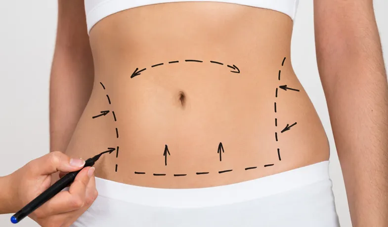 TB Cirugia Estetica 0001 Abdominoplastia 300x176 1