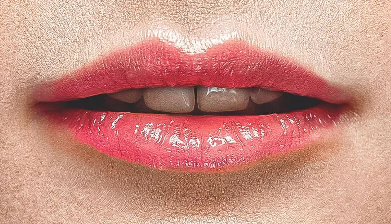 Aumento labios imagen antes