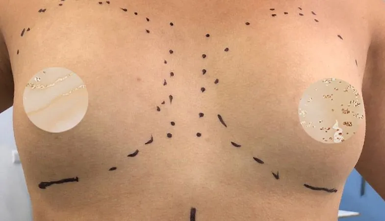 Aumento mamas imagen antes